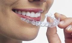 Invisible Braces