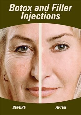 Botox and Fillers Injection