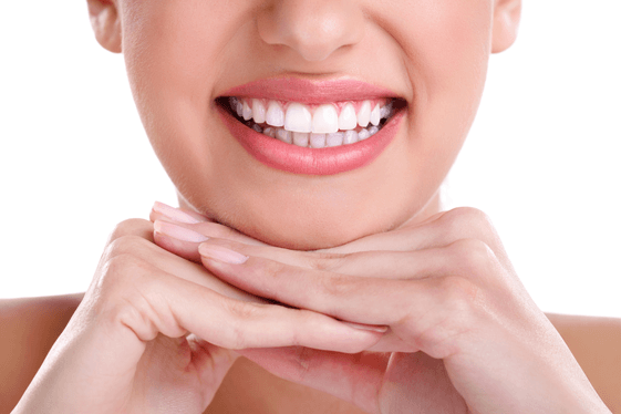 Private Dentist in Catford - Teeth Whitening in Catford - Photo of a woman smiling