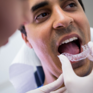 Teeth Straightening in Lee, London: Everything You Need to Know