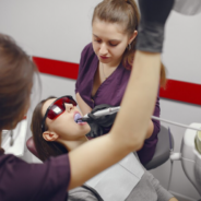 Dental Bonding in Lewisham, London: Your Complete Guide to a Confident, Natural-Looking Smile
