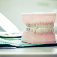 What Are the Signs of a Failing Dental Crown?