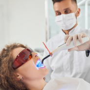Teeth Whitening in Lee, London: Everything You Need to Know