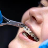 Affordable Dentist in Catford