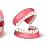 What Is Cosmetic Dentistry and Is Any of It Available on the NHS?