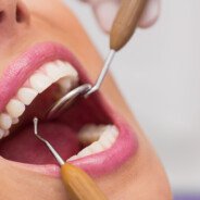 How to Prepare Your Child for Their First NHS Dental Visit